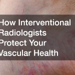 How Interventional Radiologists Protect Your Vascular Health